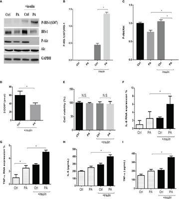 PDIA4, a new endoplasmic reticulum stress protein, modulates insulin resistance and inflammation in skeletal muscle